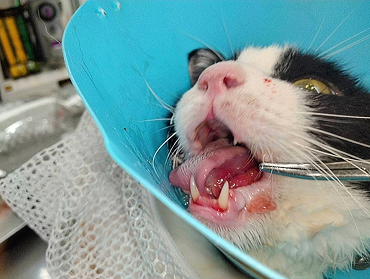 治療開始前