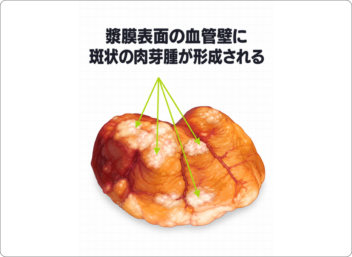 FIPの解説図